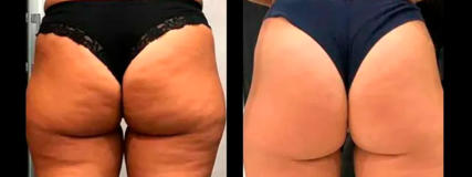 Entrenador Personal - Personal Training - Gimnasios - Boadilla del Monte